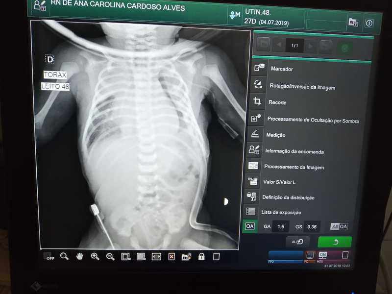 Maternidade de Teresina recebe Raio X portátil e melhora atendimento a crianças internadas