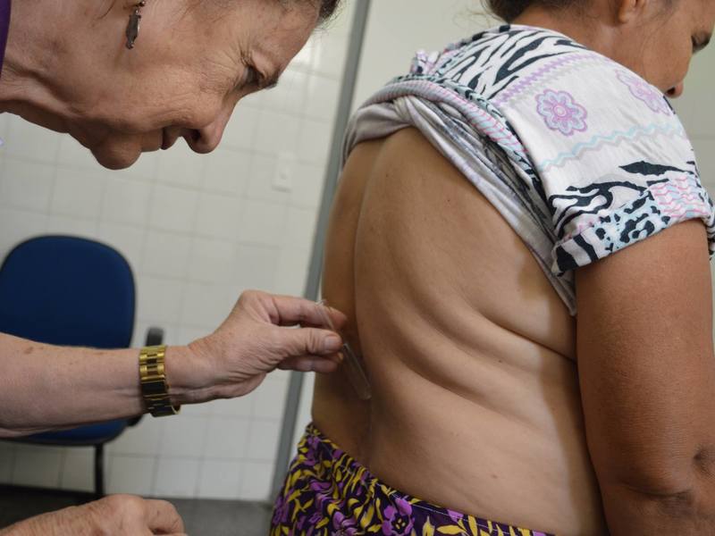 Hospitais de Teresina realizam Mutirão para Diagnóstico de Hanseníase