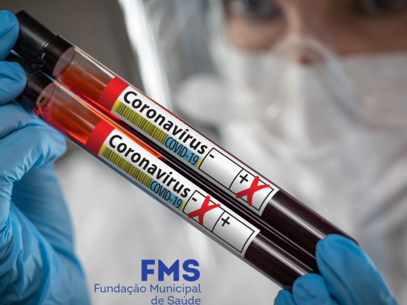 Hospitais, farmácias e laboratórios deverão informar à FMS os resultados de testes para a Covid-19